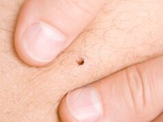 Oprez u prirodi: Krpelji prenose opasne bolesti – evo kako da se zaštitite